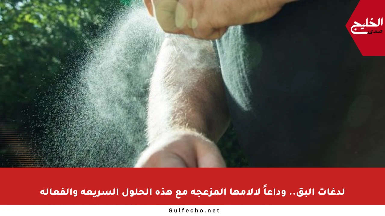لدغات البق.. وداعاً لآلامها المزعجة مع هذه الحلول السريعة والفعالة